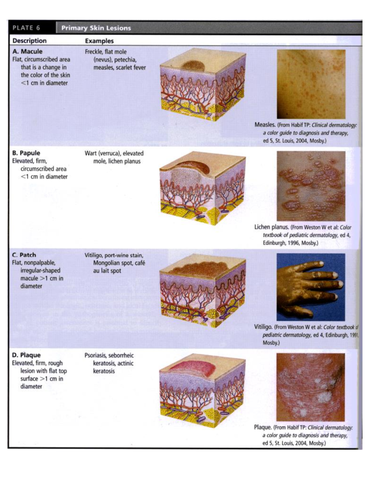 Examples Of Primary Skin Lesions