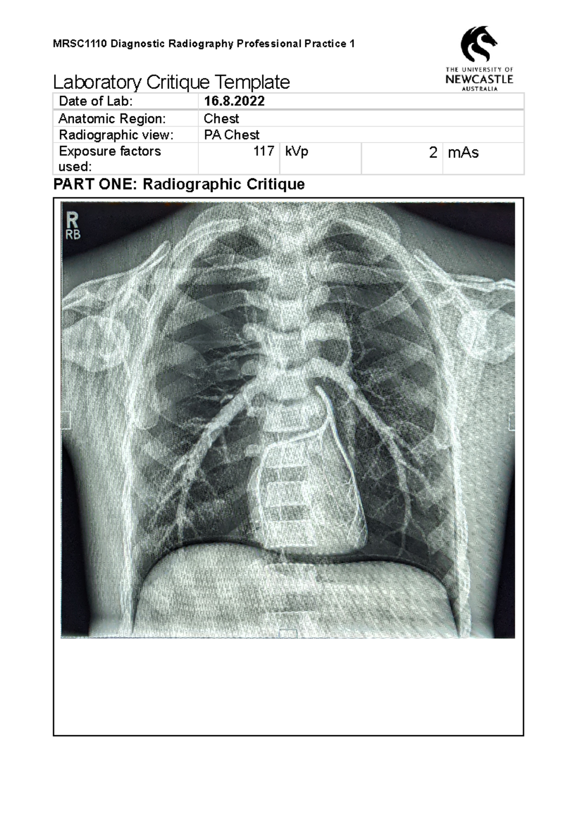 Lab Critique for PA Chest Radiograph - MRSC1110 - Studocu