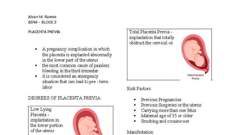 BSN4 - Block 2: Placenta Previa - Overview of Complications and Care ...