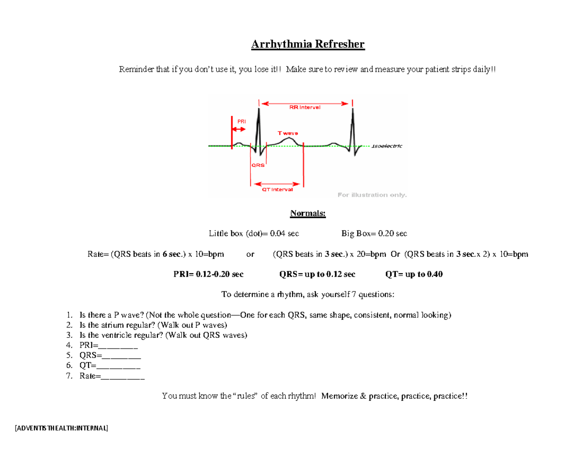 Arrhythmia Study Guide Refresher: Key Concepts & Rhythm Analysis - Studocu