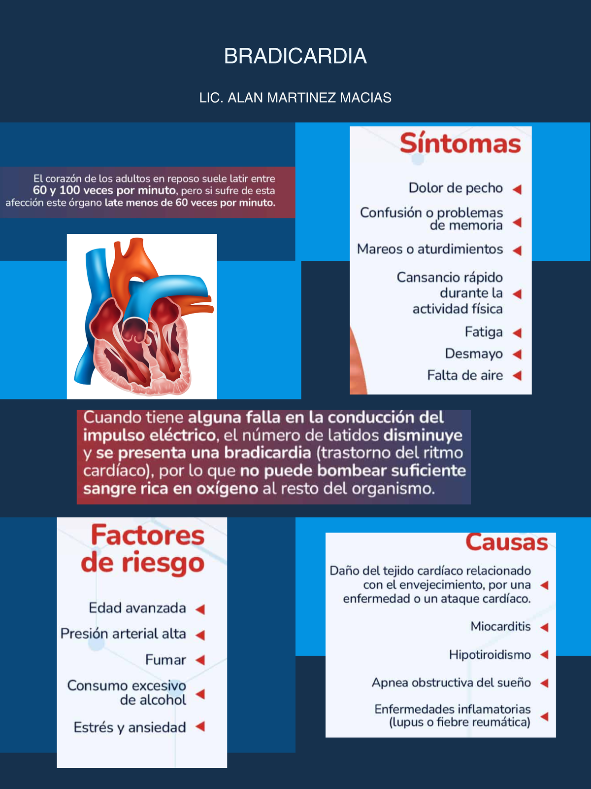 Infografia DE Bradicardia - BRADICARDIA LIC. ALAN MARTINEZ MACIAS ...