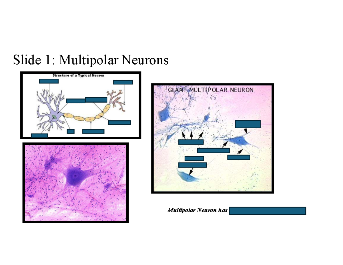 Multipolar Neuron Histology Slide
