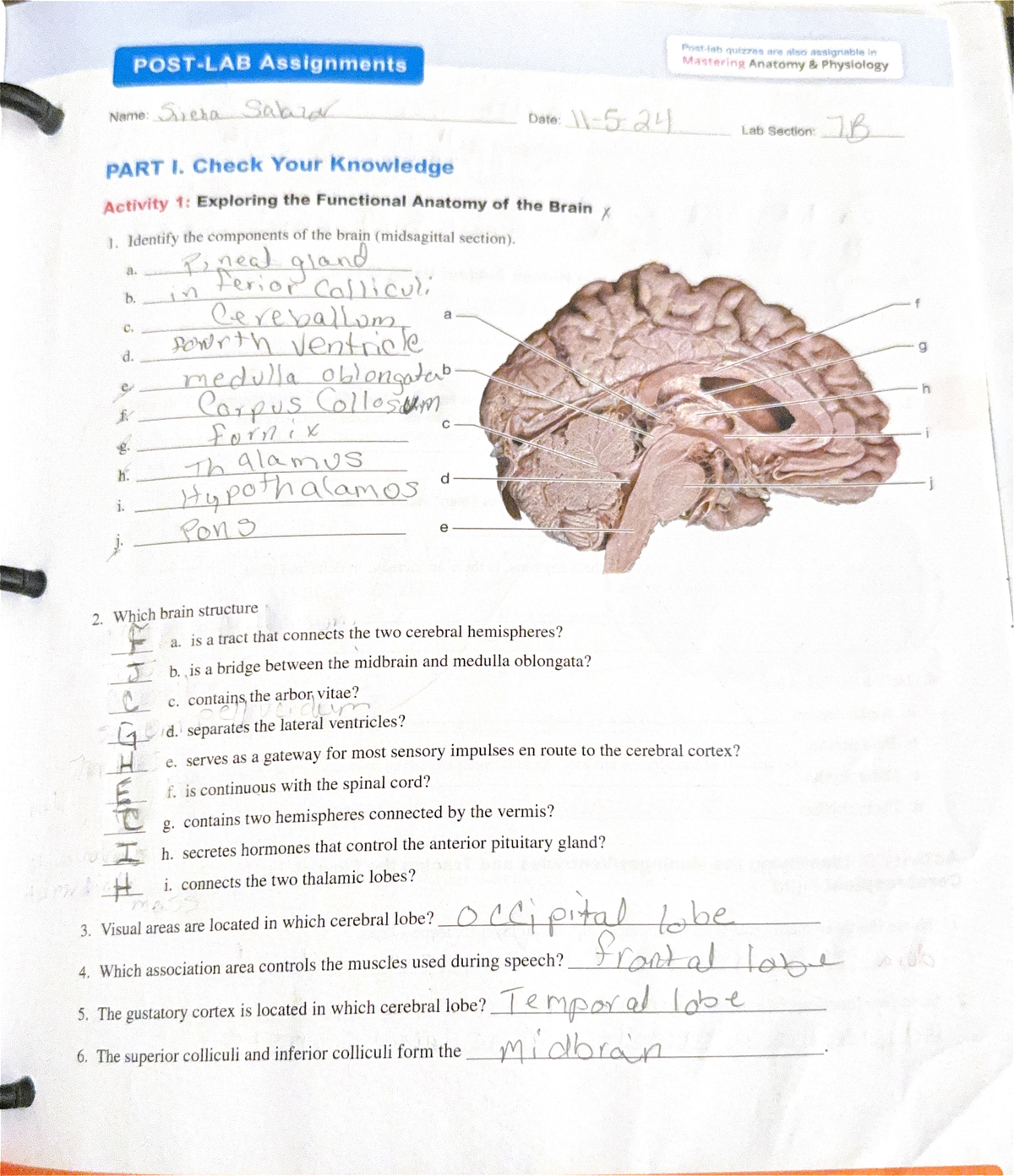 CNS 15 Post Lab - Exploring Functional Anatomy of the Brain Assignment ...
