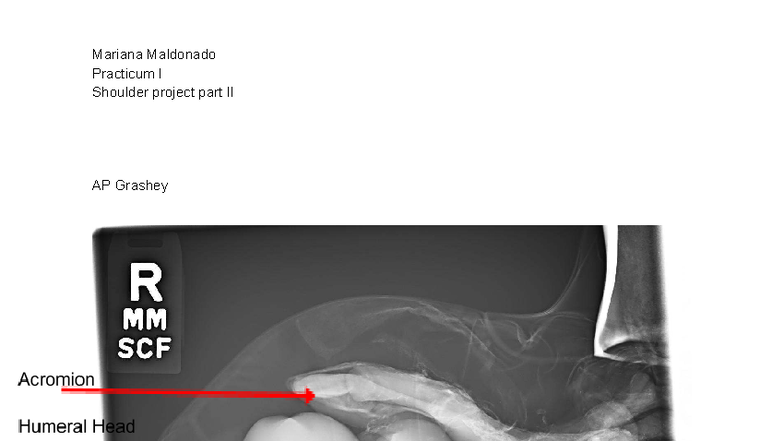 Practicum I Shoulder Project Part II: AP & Axial Techniques - Studocu