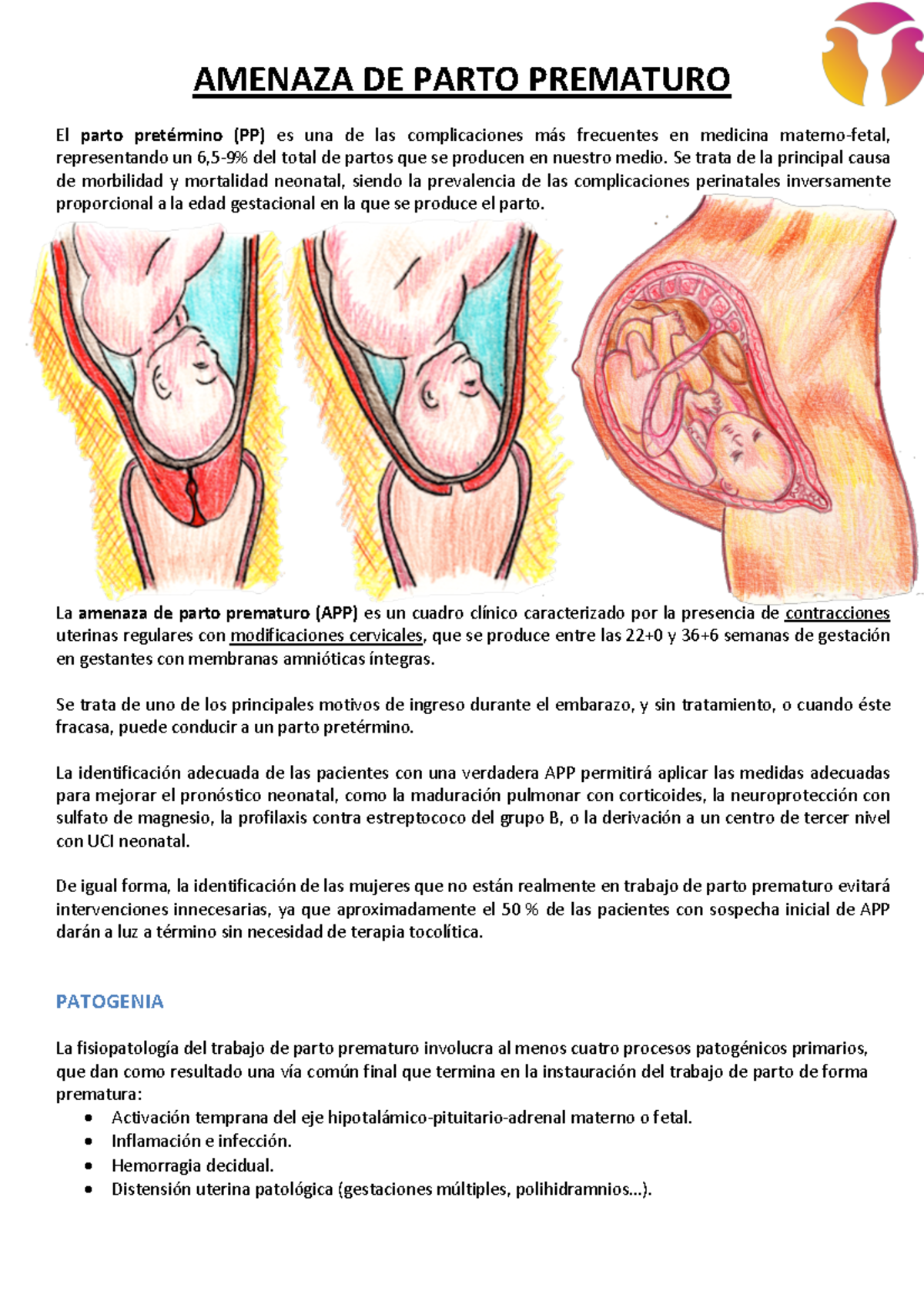Amenaza de Parto Prematuro: Diagnóstico y Manejo Efectivo - Document Preview