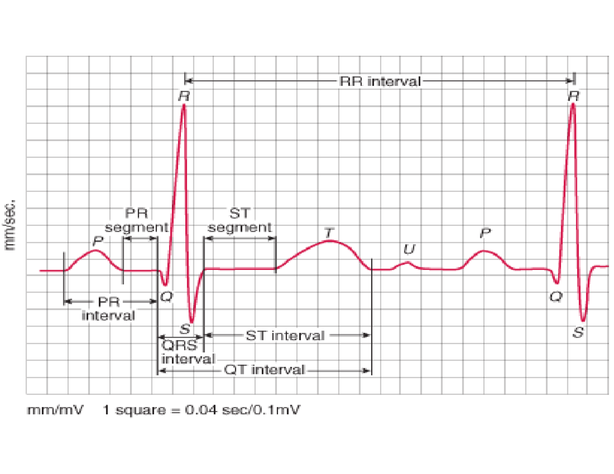 ECG Trace Student - Notes - NUR2222 - RR interval R R PR ST segment ...