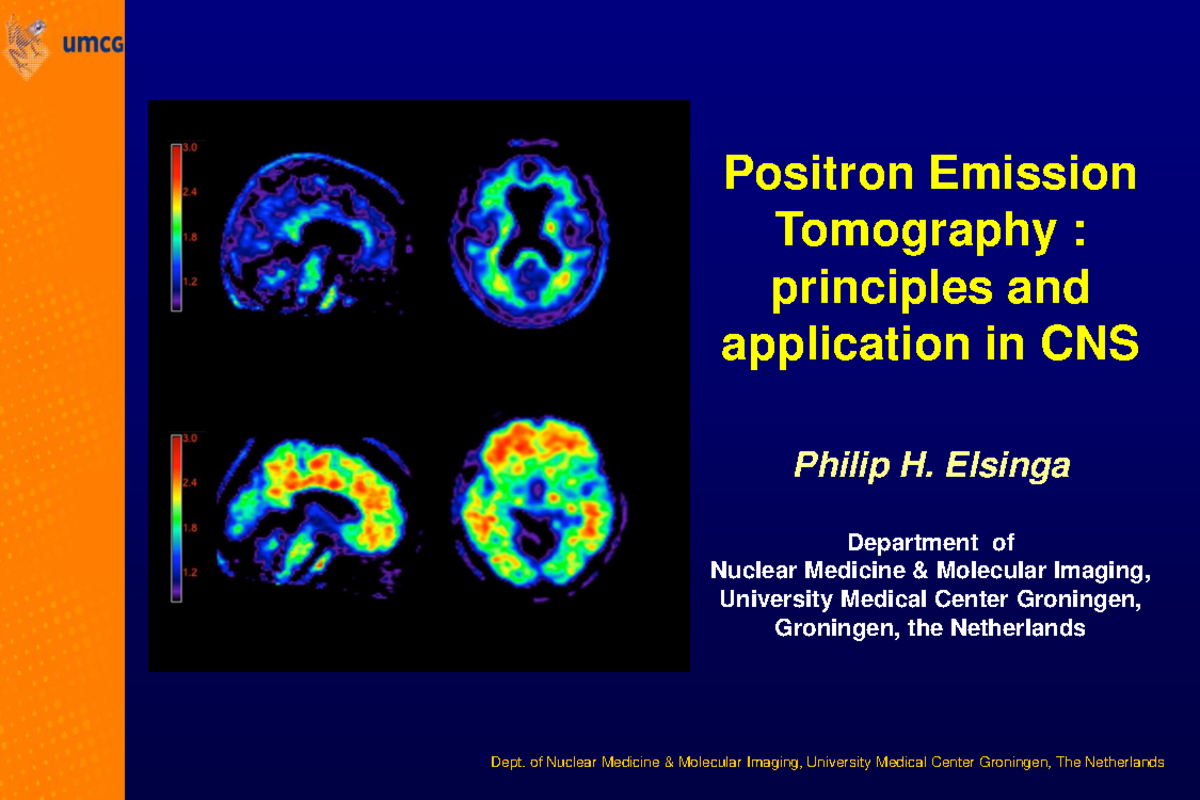 PET Imaging Techniques and Applications in CNS Disorders (Nuclear Med ...