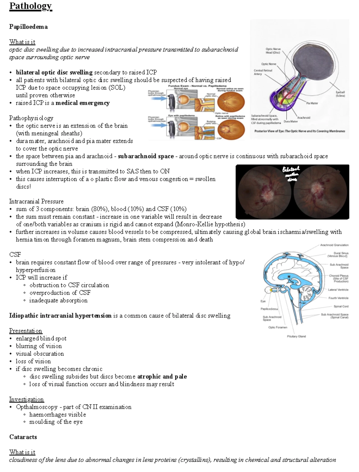 Vestibular neuronitis - Vestibular Neuronitis Vestibular neuronitis ...