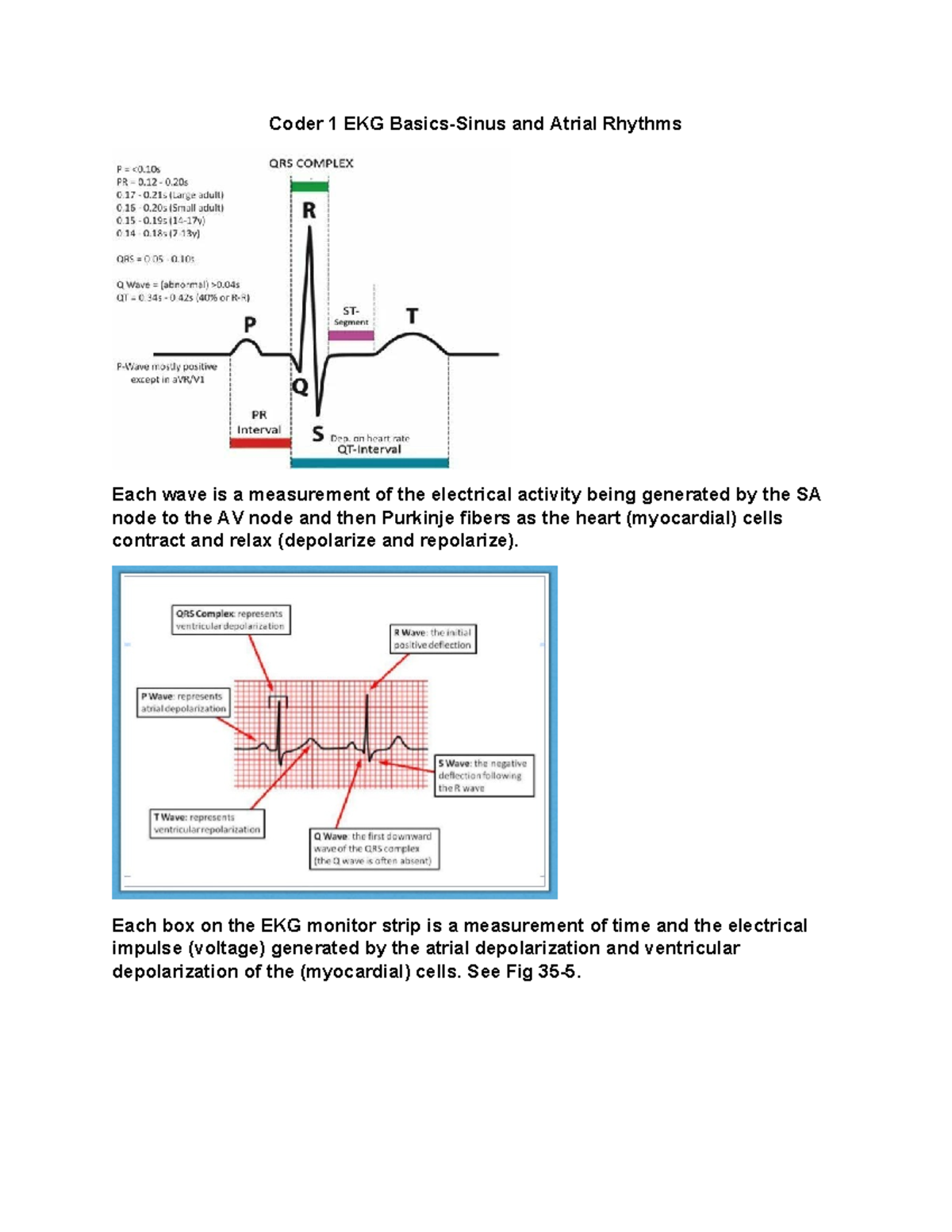 Coder 1 EKG Basics: Sinus and Atrial Rhythms Study Guide - Studocu