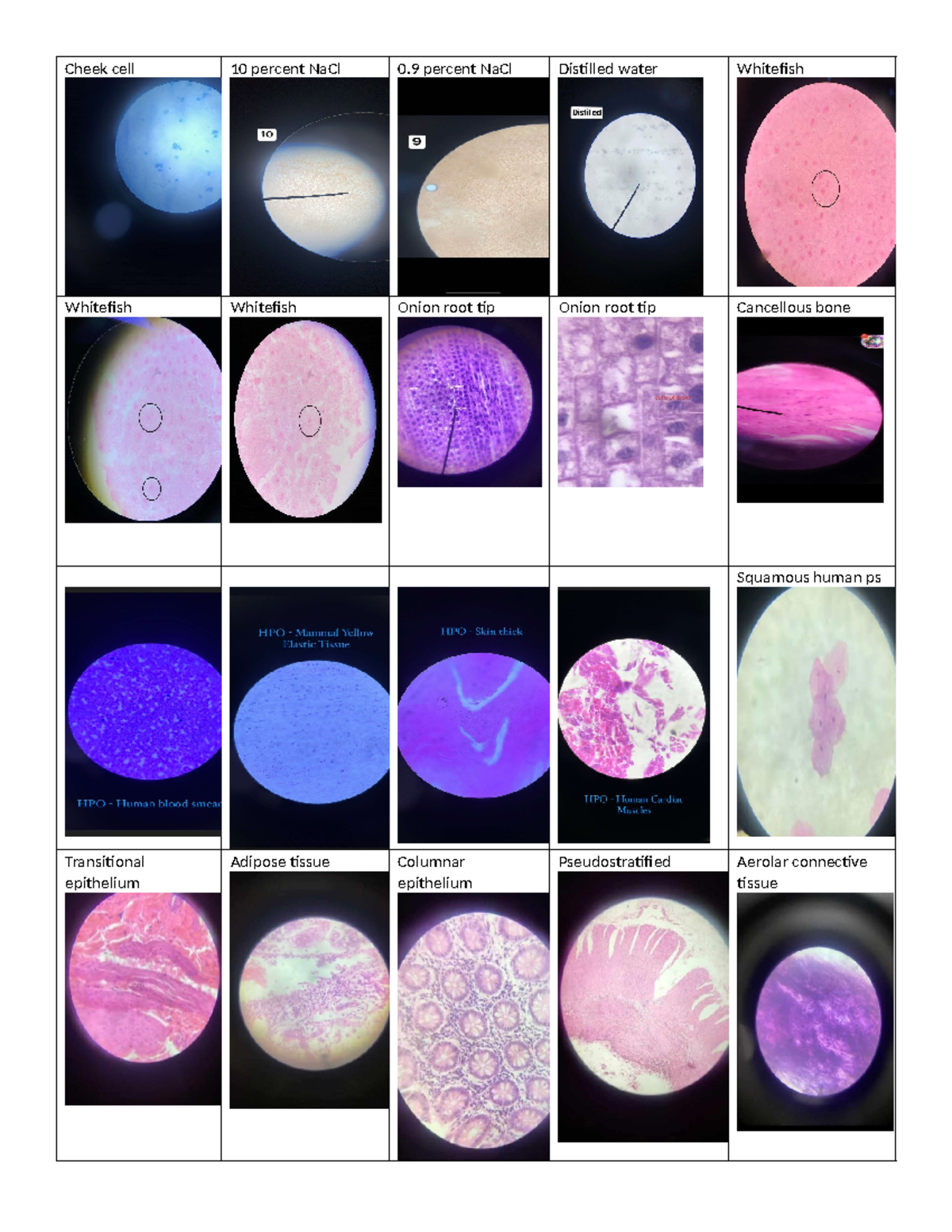 Cheek-cell - photo microscopic reviewer - Anatomy and Physiology ...