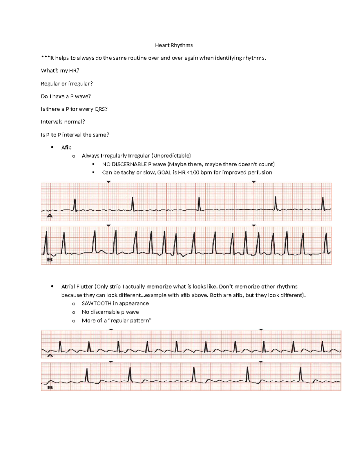 Heart Rhythms Cheat Sheet: Identifying Regular vs Irregular Patterns ...