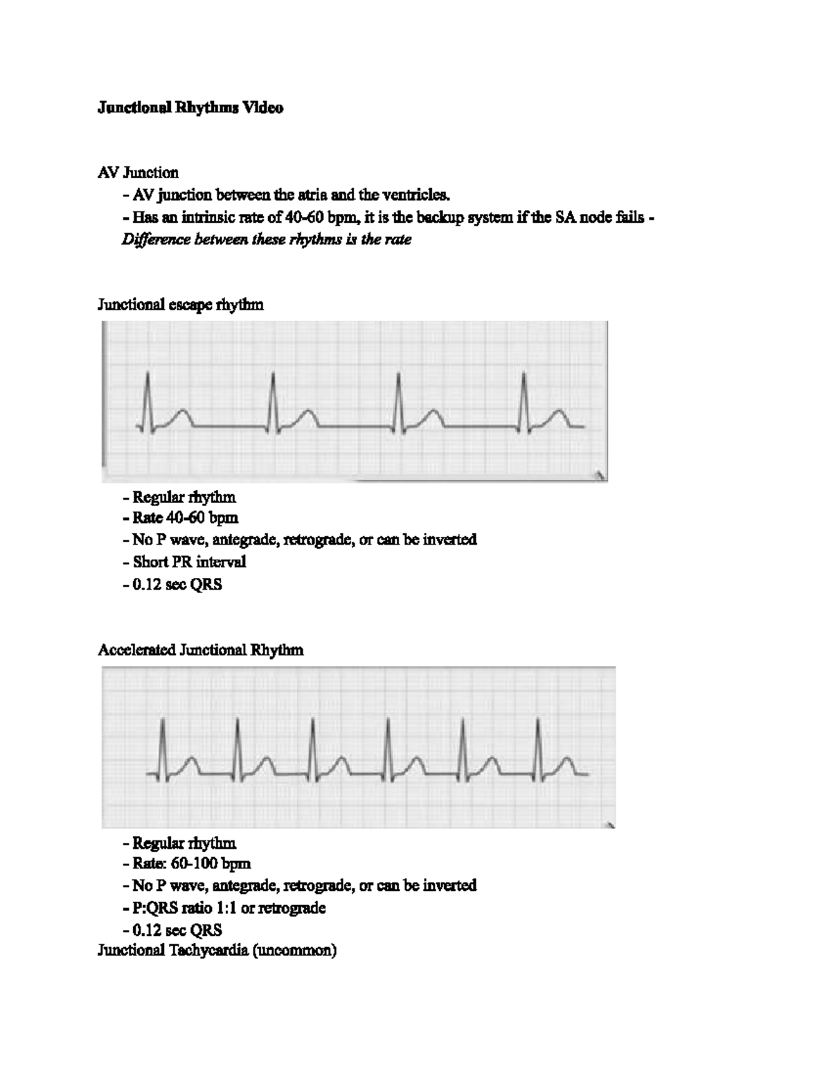 NUR 409 Critical Care Test 2 Study Guide: Junctional Rhythms & Heart ...