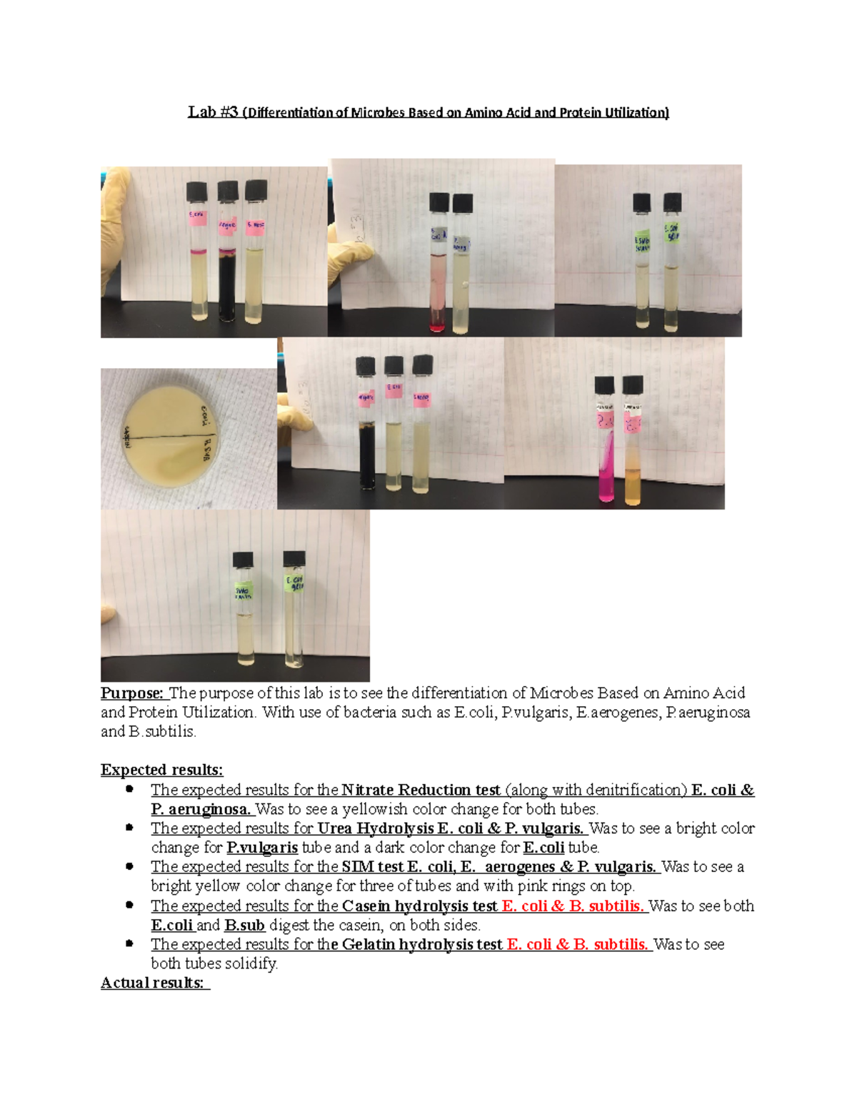 Micro LAB 3 - Differentiation of Microbes and Protein Utilization - Studocu