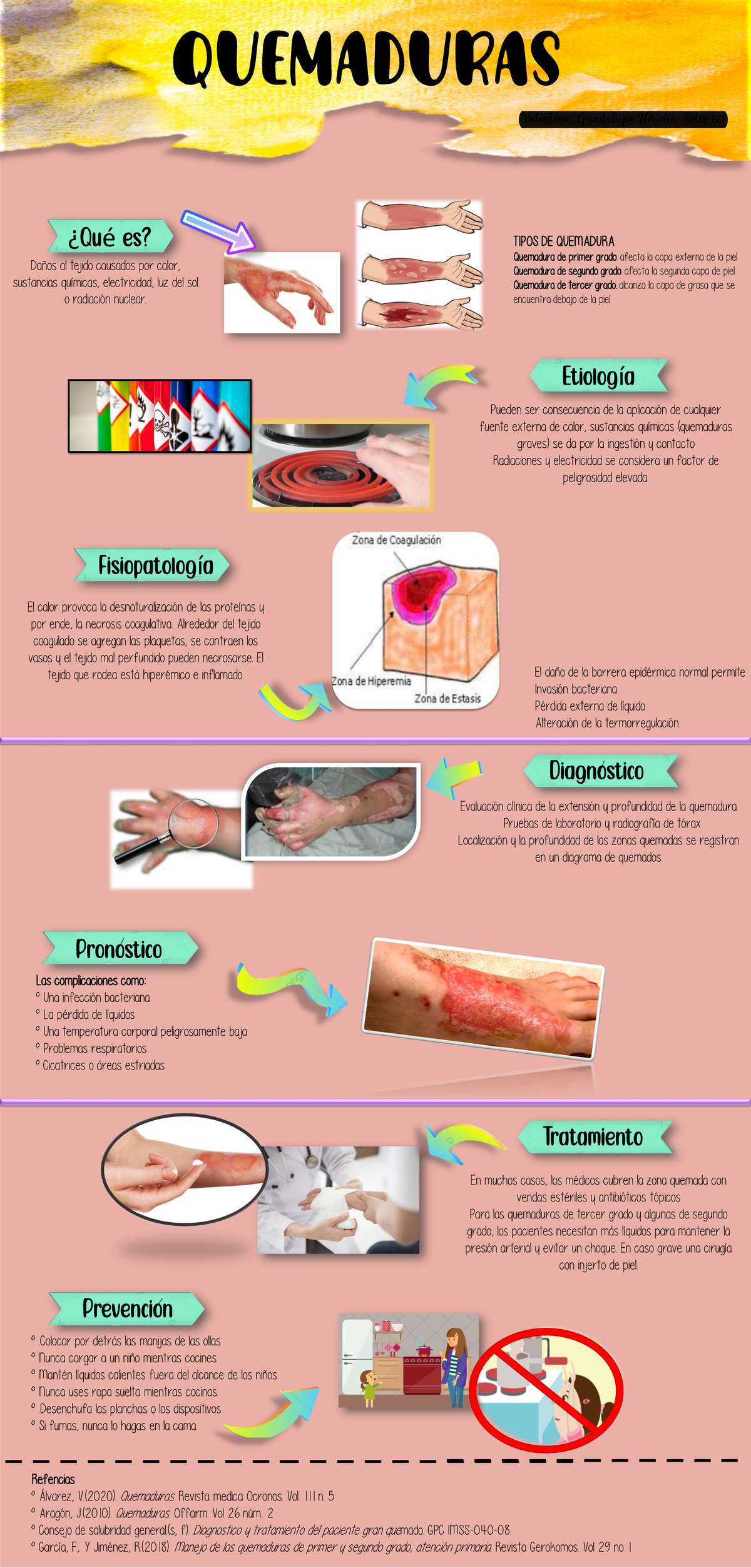 Diagrama De Quemadura De Tercer Grado HOSPITAL DEL NIÑO DOCTOR JOSÉ