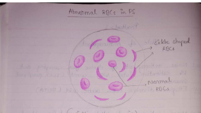 Patho Clinical Practical: Abnormal RBCs and Anemia Class Notes (ATO7 ...