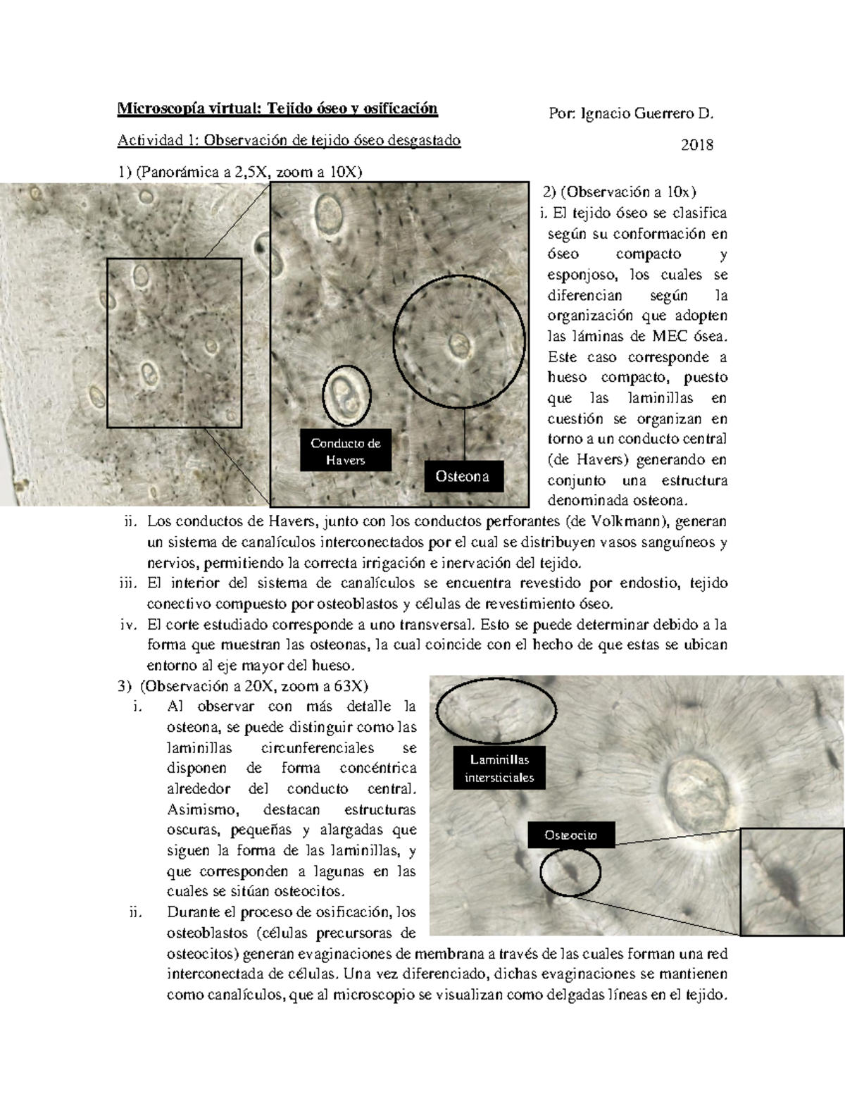 -Histo Embrio- MV 1 Hueso Osificación - Ignacio Guerrero D ...