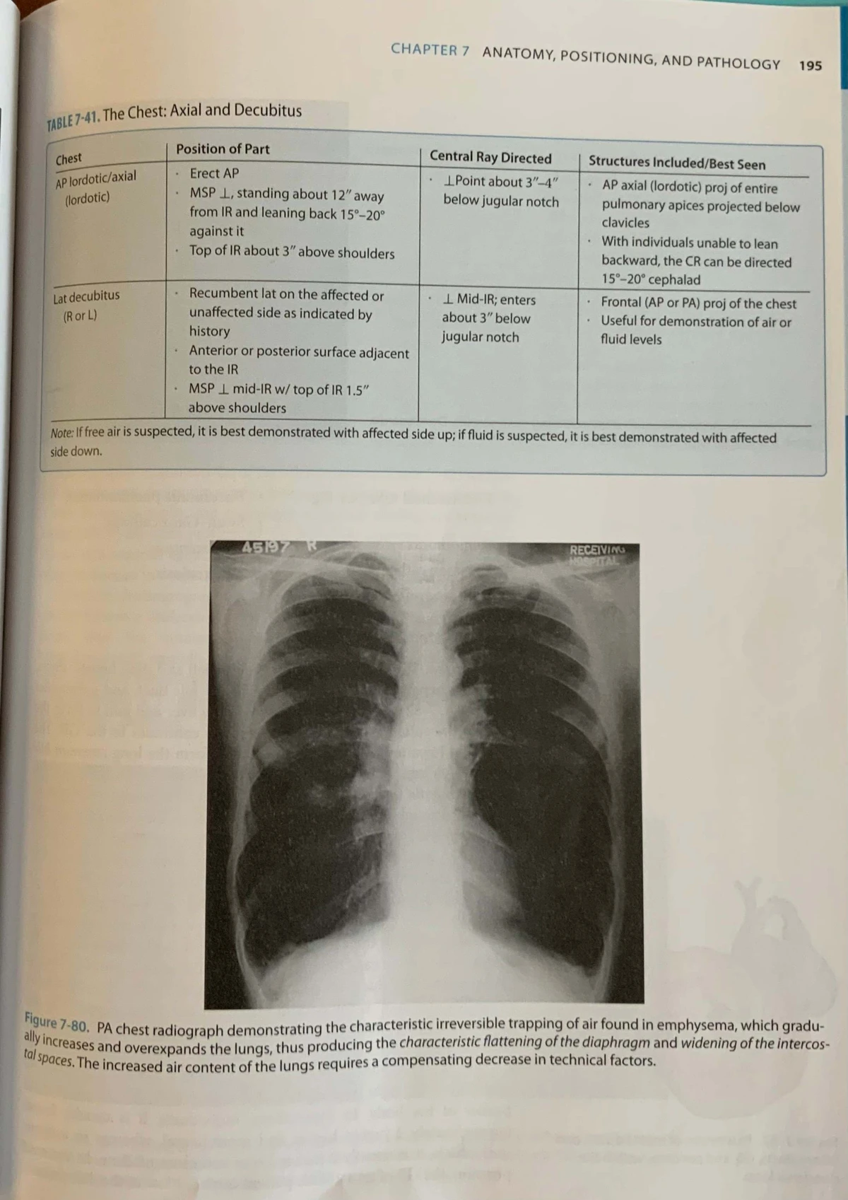 Comprehensive Guide to Respiratory System & Chest Radiography ...
