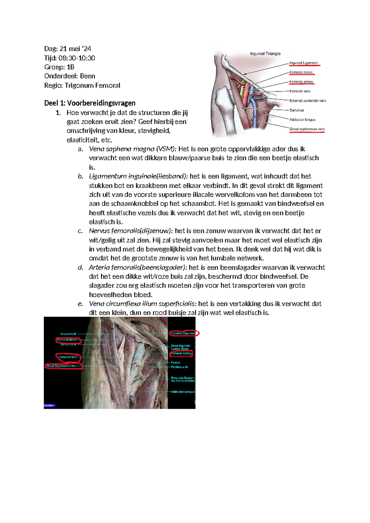 Dissectieplan Practicum 1: Trigonum Femoral en Structuren Analyse ...