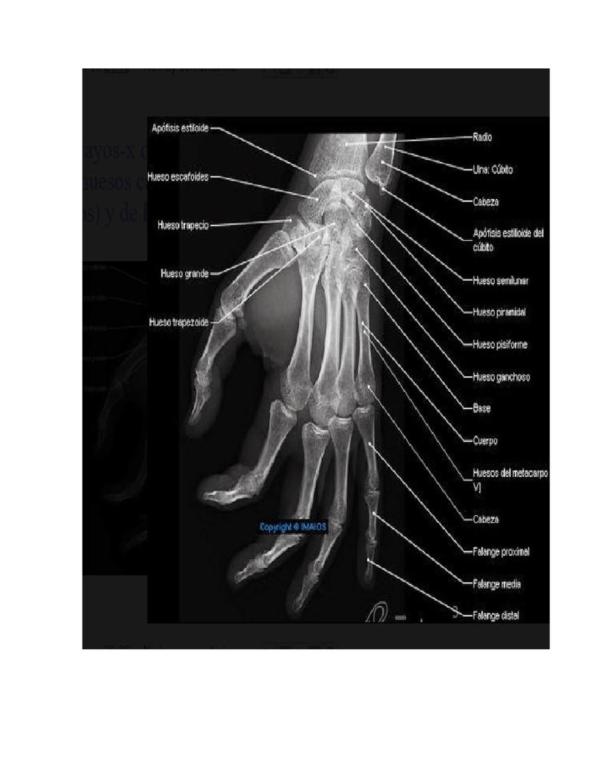 Radiografía de las Manos: Anatomía de Huesos y Estructuras 9ATJ - Studocu