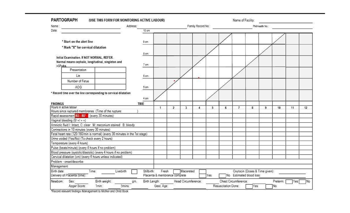 Partograph Guide for Active Labour Monitoring - PARTO - Studocu