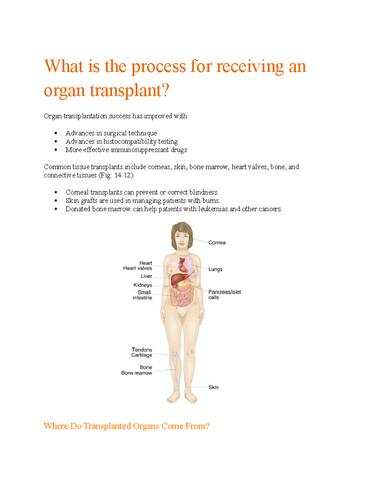 Organ Transplantation Process and Success Factors - Studocu