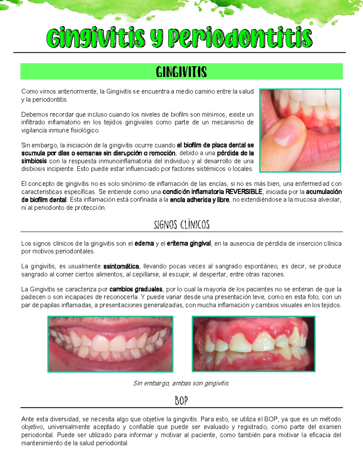 Examen PSR - Examen de los tejidos periodontales Sonda periodontal ...