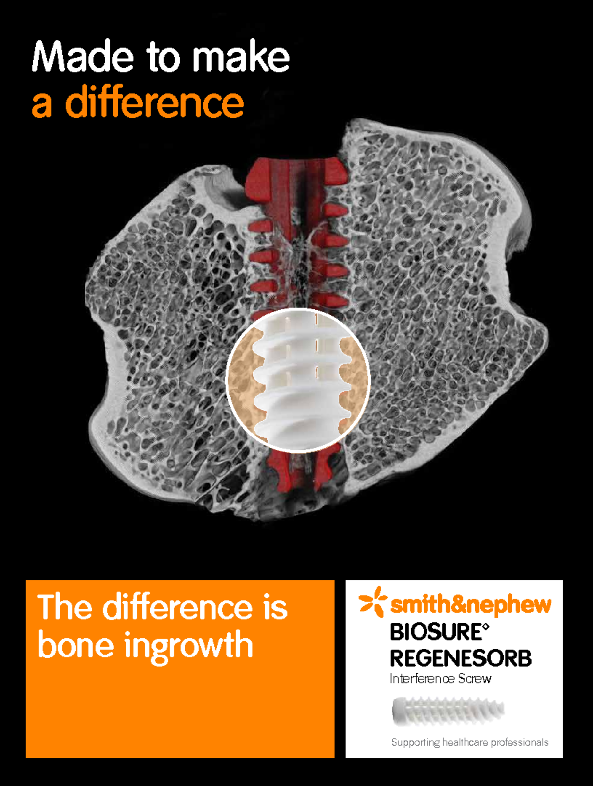 Biosure regenesorb interference screw brochure 07344 - Supporting ...