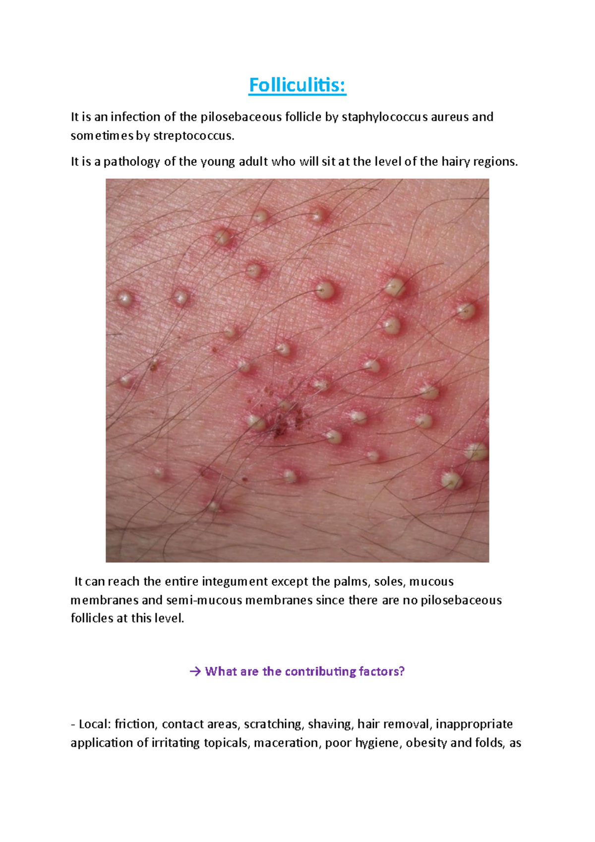 How To Get Rid Of Ingrown Hairs | Tips To Remove And Prevent Them! –  CHEEKYGLO, image size:1200x1696