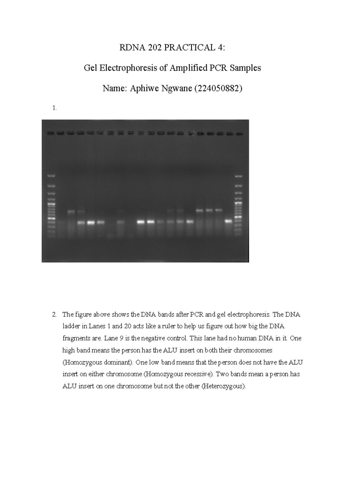 RDNA 202 Practical 4: Gel Electrophoresis of PCR Samples Analysis - Studocu