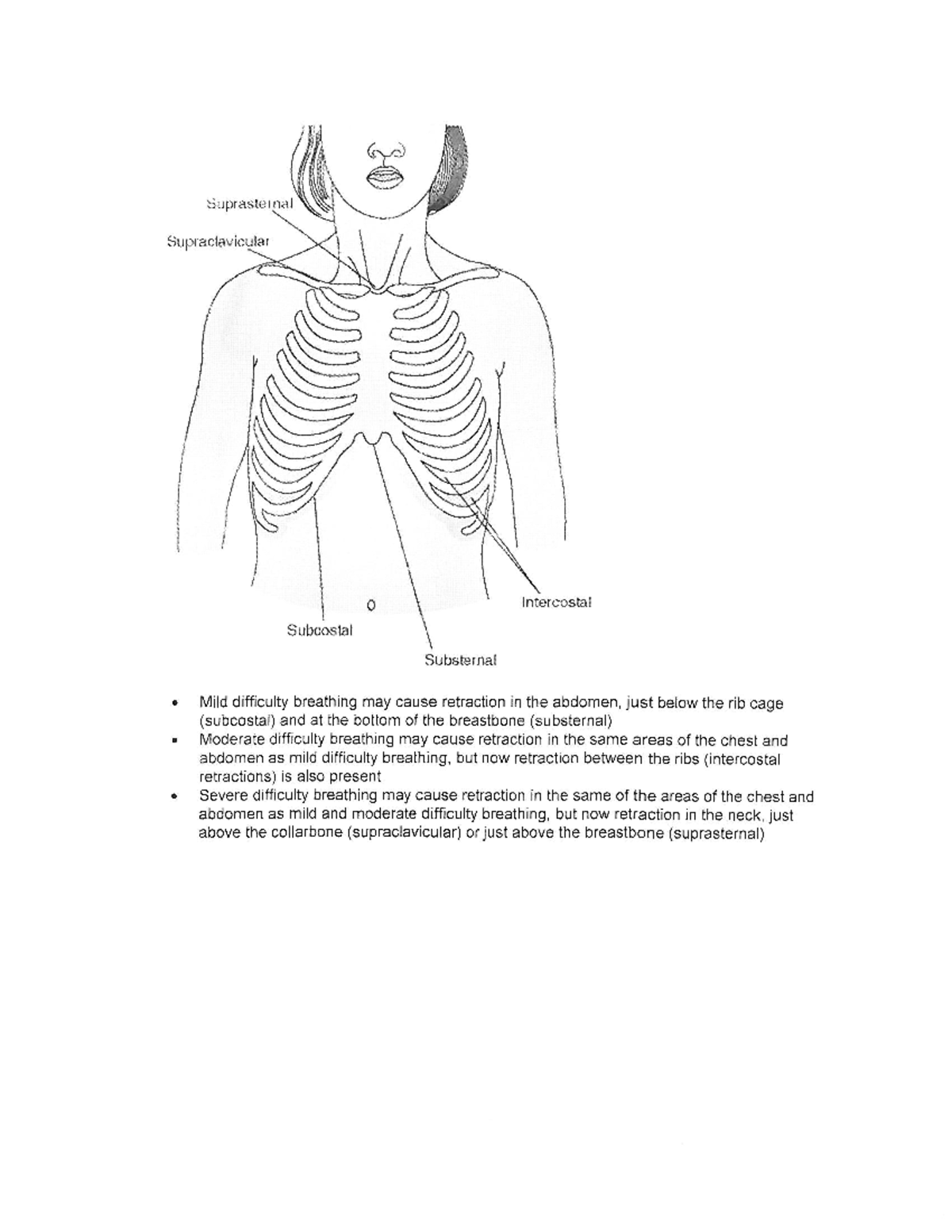 Respiratory Retraction Sites: Mild to Severe Difficulty Breathing - Studocu