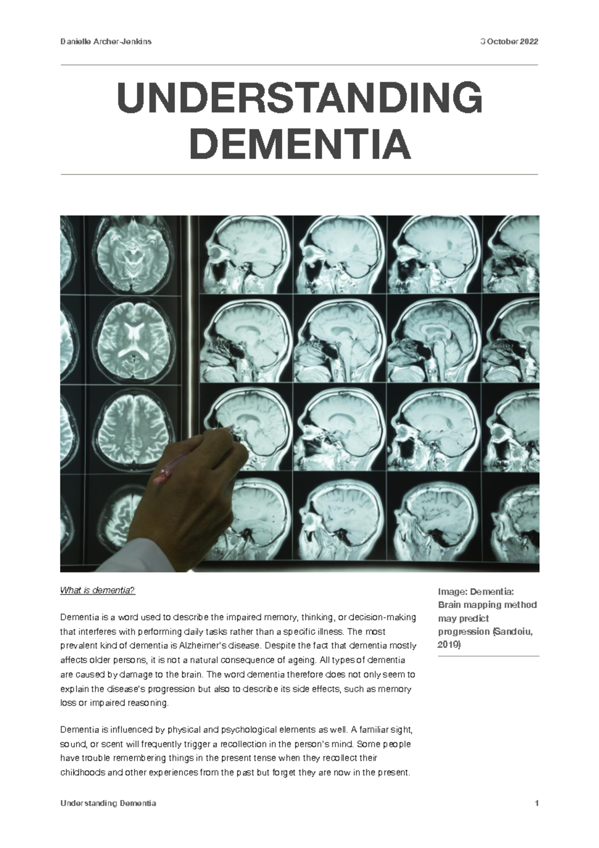 Understanding dementia academic journal - Image: Dementia: Brain ...