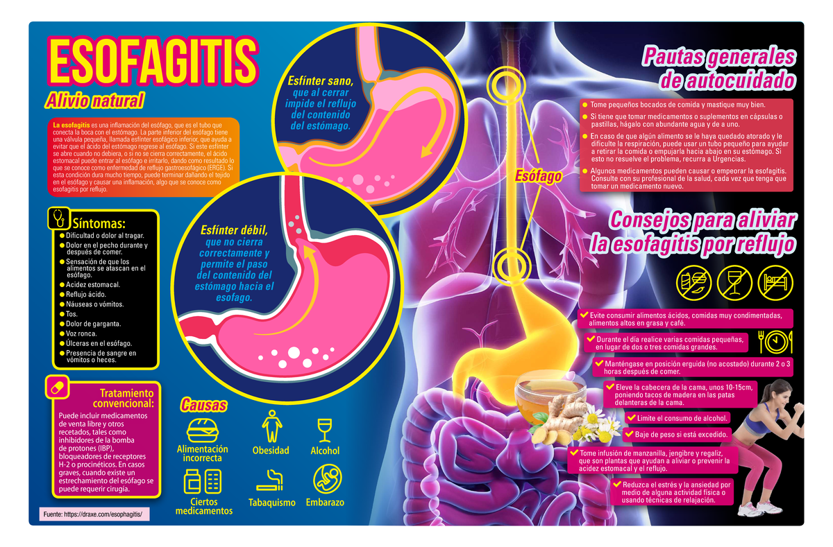 Infografía sobre el Alivio Natural de la Esofagitis - Studocu