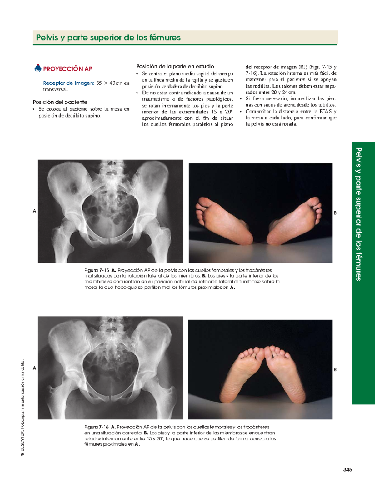 Proyección AP de Pelvis y Fémures: Técnica y Criterios Radiológicos ...