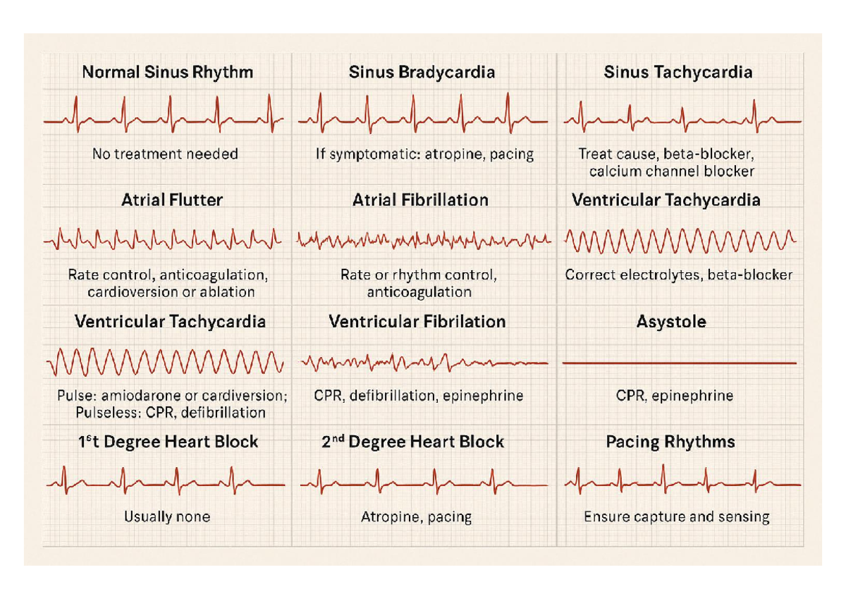 Cardiac Rhythms Treatment Guide: Conditions & Interventions - Studocu