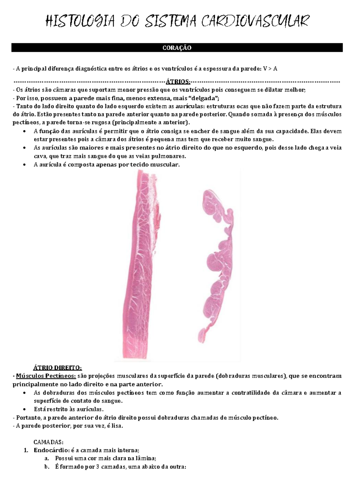 Histologia do Sistema Cardiovascular - Aula 1 Análise dos Átrios e ...