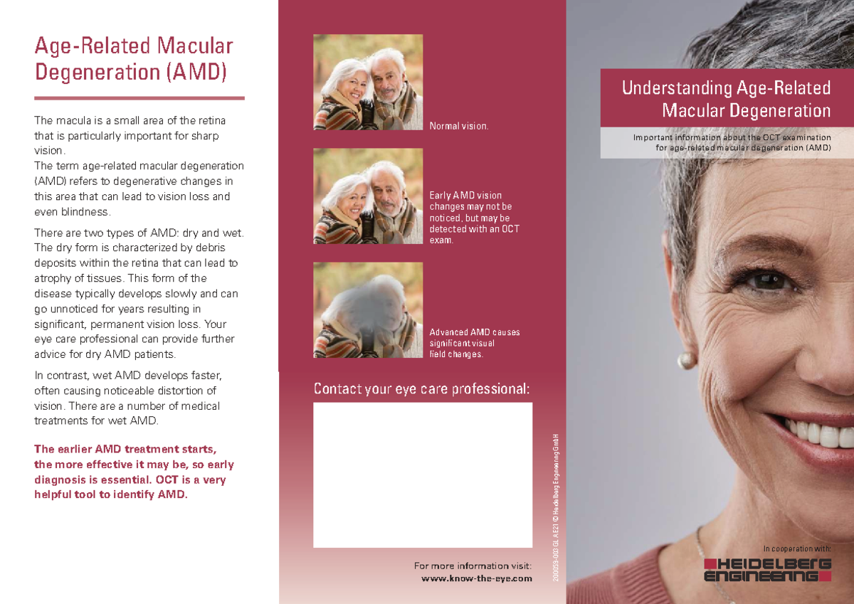 Understanding Macular Degeneration (AMD) - 2000 59-003 Spectralis ...