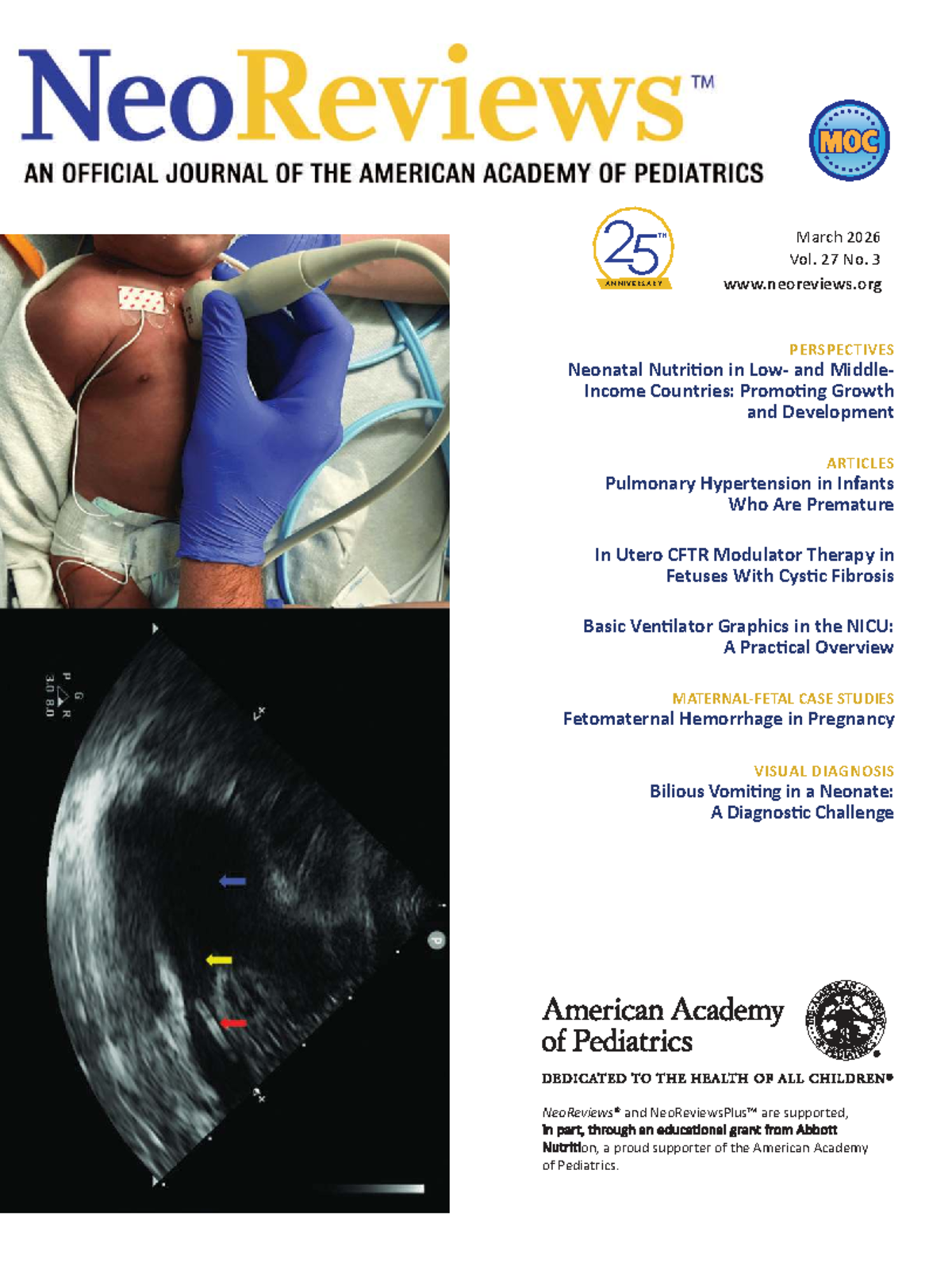 Neoreviews Vol. 27 No. 3: Neonatal Nutrition & Pulmonary Hypertension ...