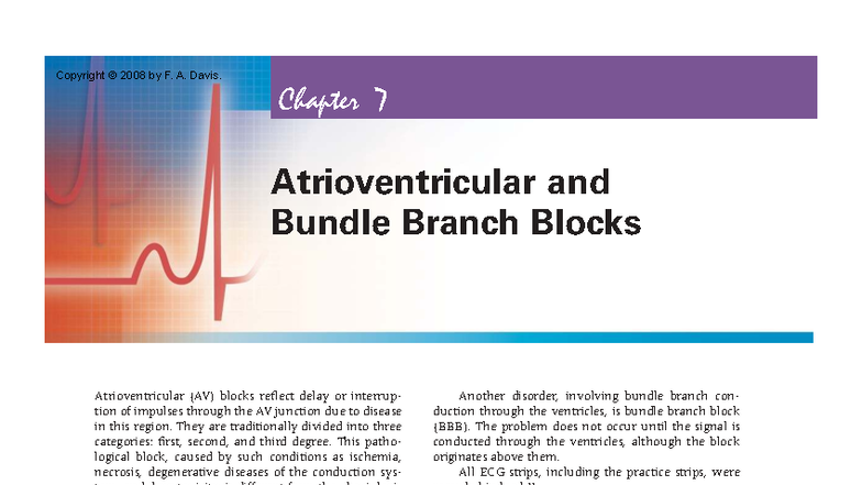 ECG Chapter 7: Atrioventricular & Bundle Branch Blocks Analysis - Studocu