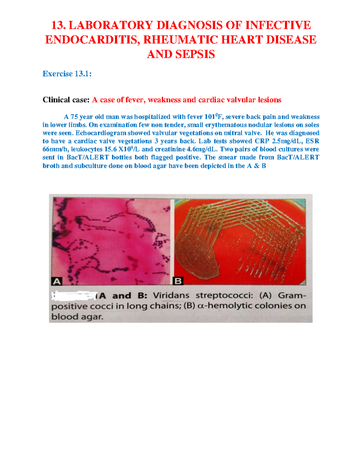 13. Laboratory Diagnosis of Infective Endocarditis, Rheumatic Fever ...
