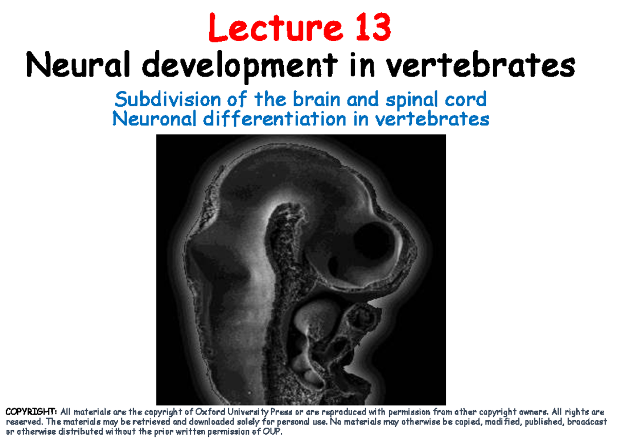 Lecture 13: Neural Development in Vertebrates - Brain & Spinal Cord ...