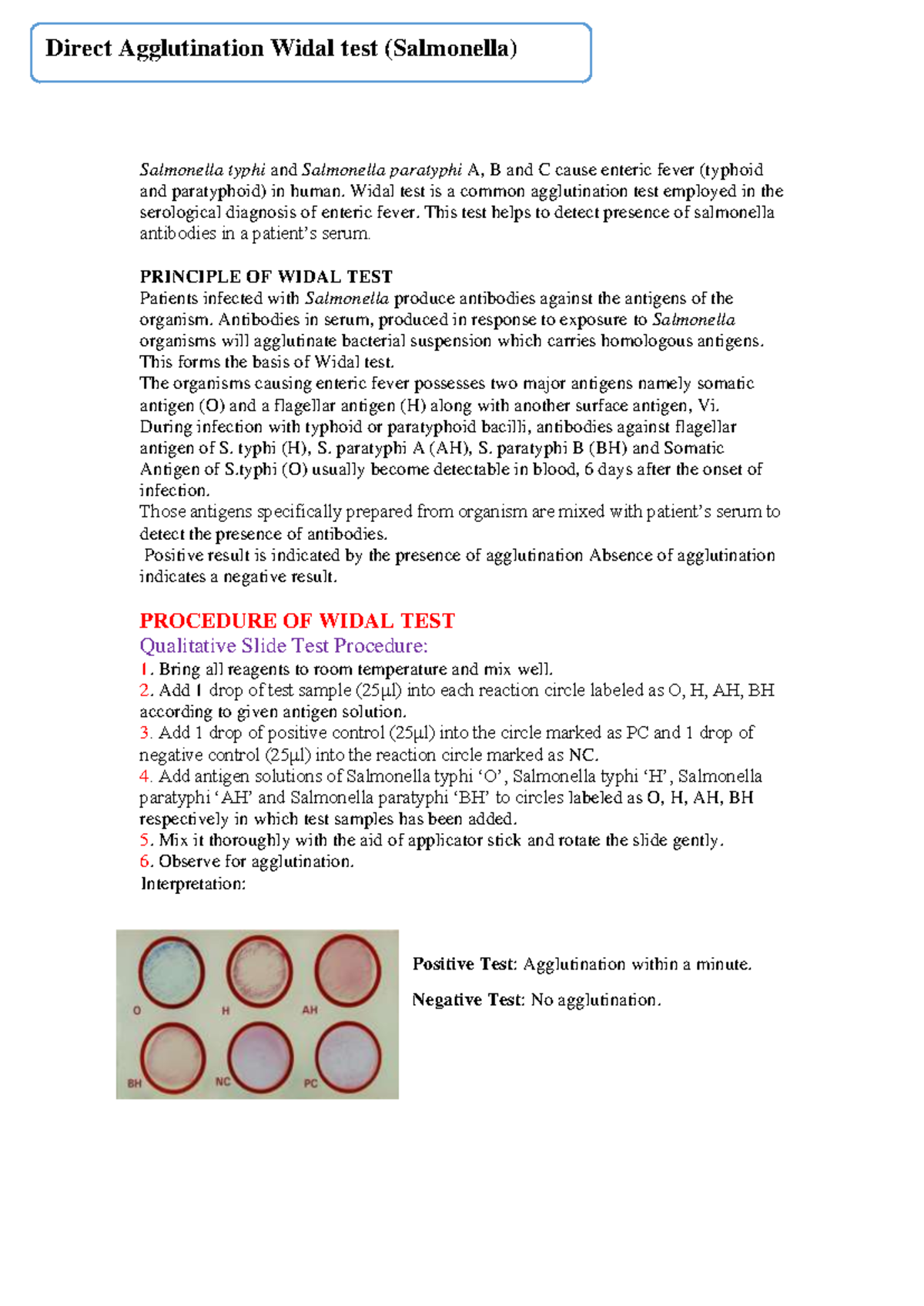 Widal Test Procedure and Interpretation for Salmonella Infections - Studocu