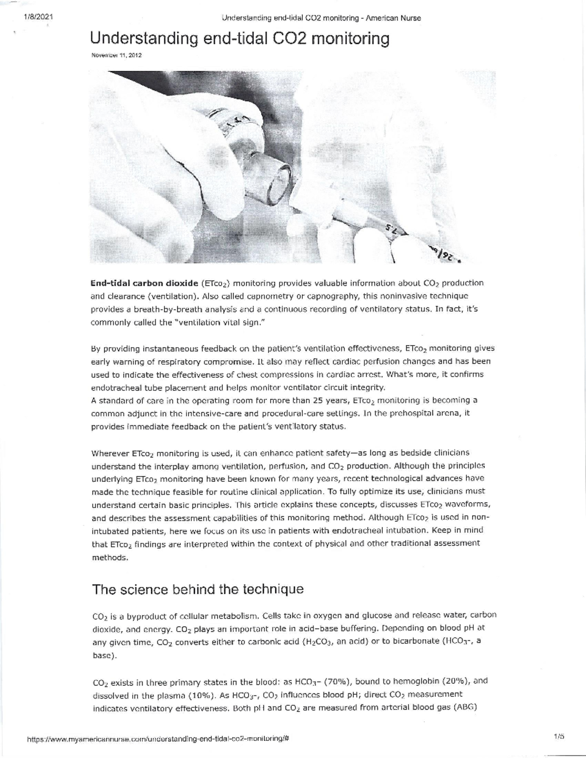 Understanding ETCO2 Monitoring: Key Concepts & Clinical Applications ...