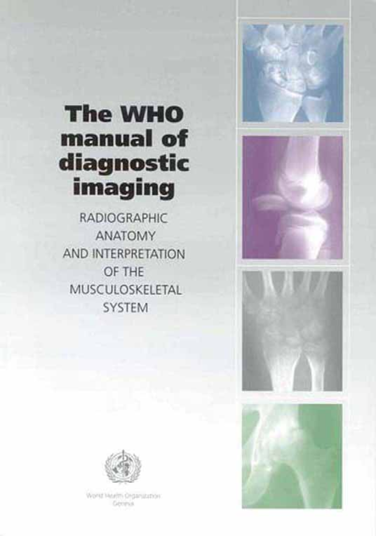 WHO Manual of Diagnostic Imaging: Musculoskeletal Radiography Guide ...
