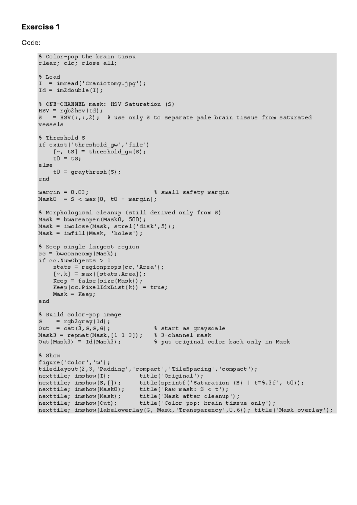 Color and Noise Report - Matlab: Exercise 1 & 3 Analysis - Studeersnel
