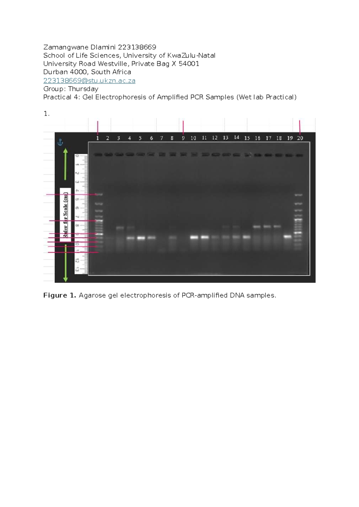 Practical 4: Gel Electrophoresis of PCR Samples (Lifesci 223138669 ...