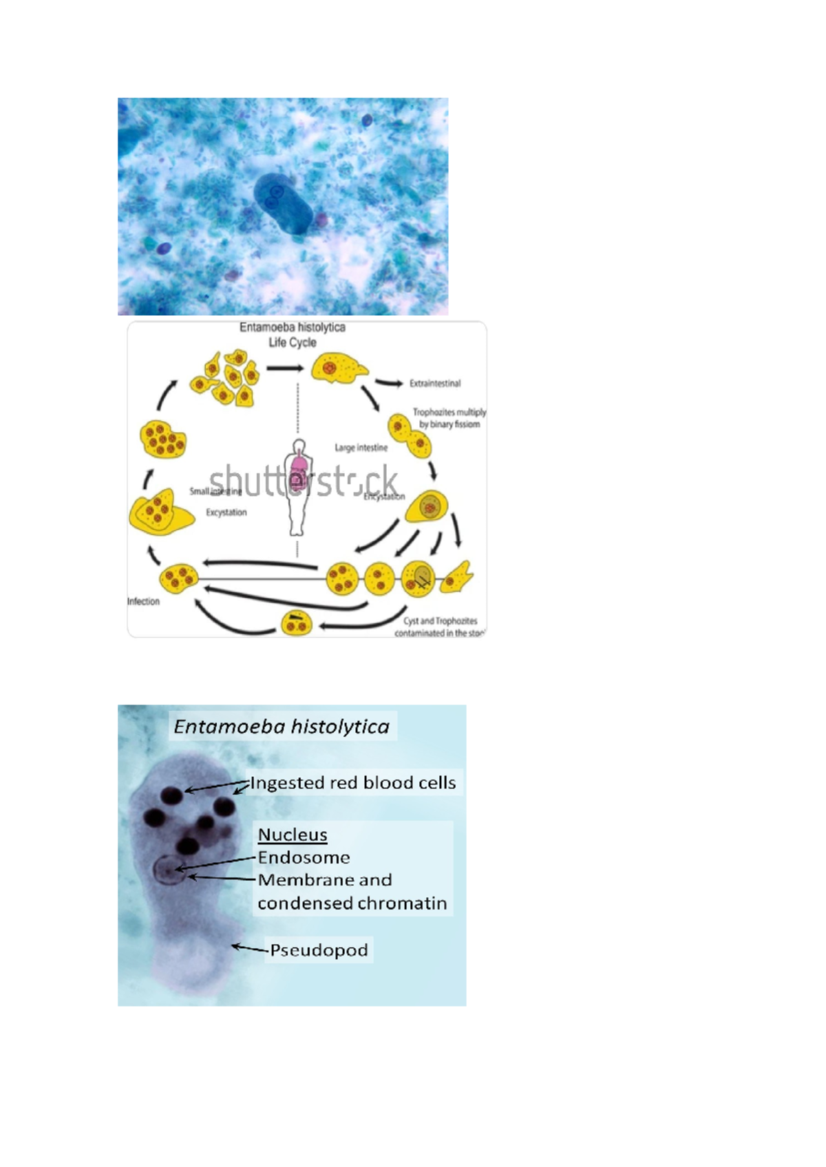 Entamoeba histolytica Life Cycle and Extraintestinal Stages - Studocu
