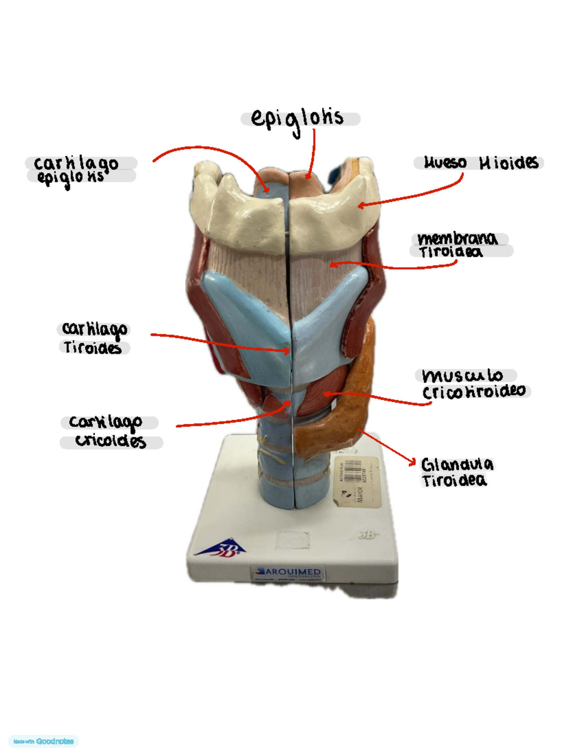 Laringe - ####### epiglotis caulilago Hueso H loides epiglo Lis & ↓ · S ...