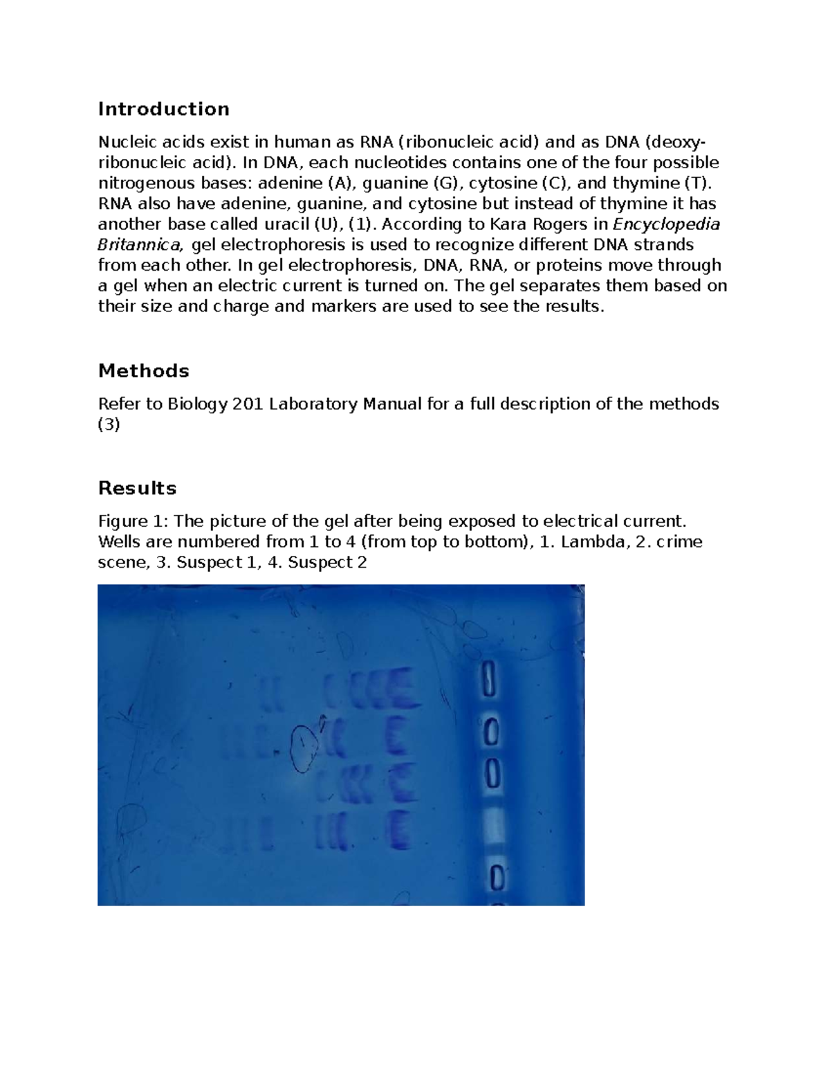 Biol 201 Lab #5: Gel Electrophoresis of DNA and RNA Analysis - Studocu