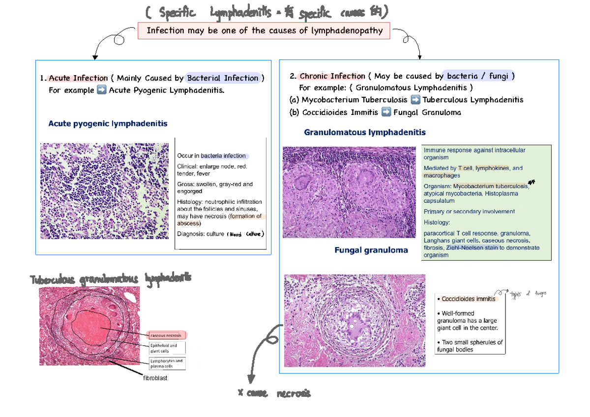 Lymphadenitis and Lymphoma: Key Concepts and Clinical Insights - Studocu