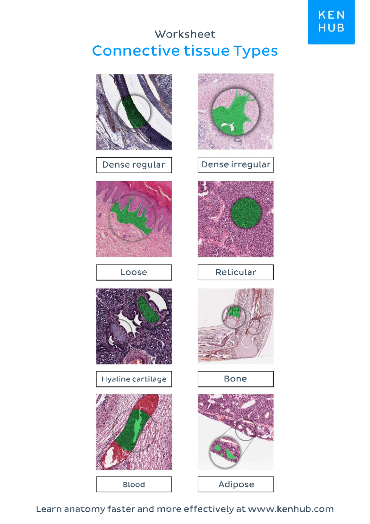 Worksheet connective tissue types labeled - Basic and Applied Human ...